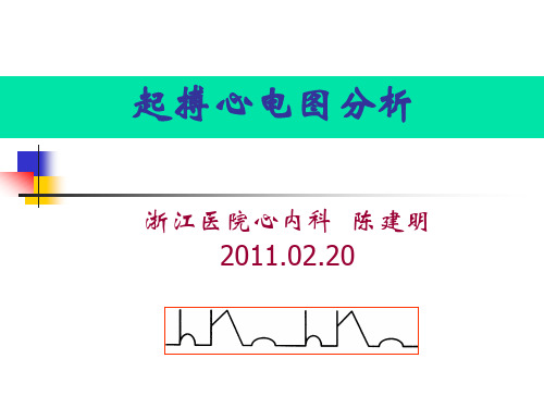 (仅供参考)起搏器心电图