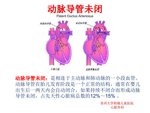 PDA幻灯片