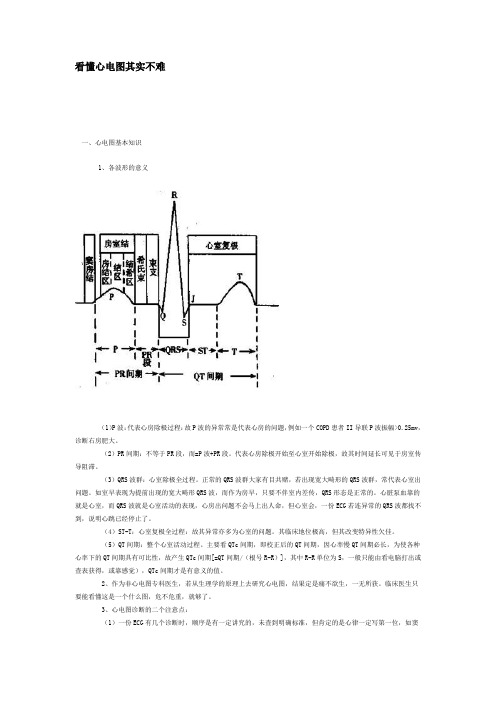 看懂心电图其实不难