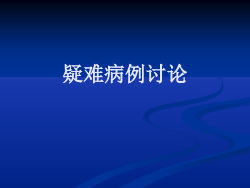 颈静脉孔区神经鞘瘤PPT课件