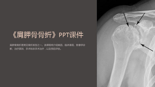 《肩胛骨骨折》课件