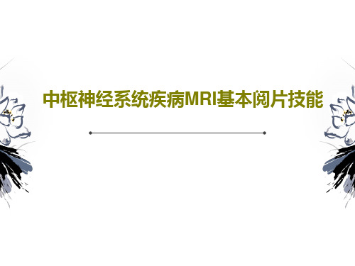 中枢神经系统疾病MRI基本阅片技能PPT共124页