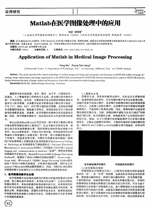 Matlab在医学图像处理中的应用