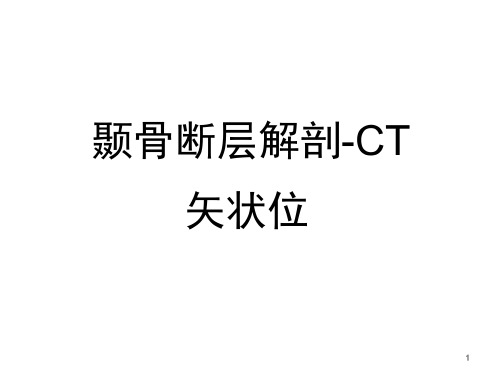 颞骨断层解剖与CT-3矢状位