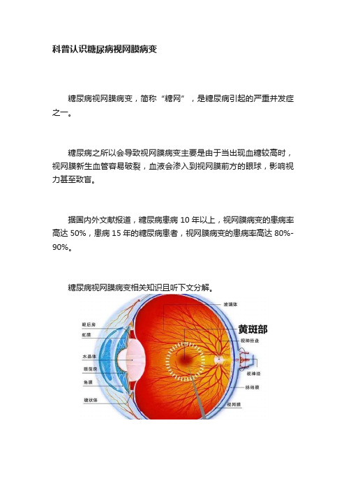 科普认识糖尿病视网膜病变