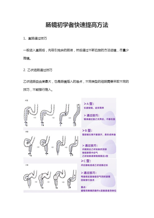 肠镜初学者快速提高方法