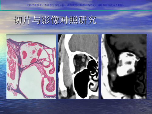 头颈部肿瘤影像诊疗和鉴别课件