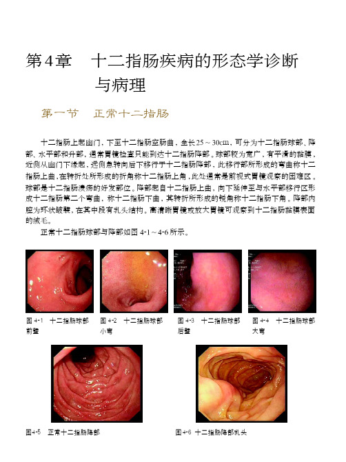 十二指肠疾病的形态学诊断与病理