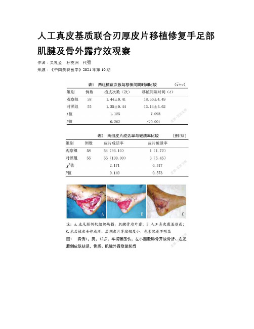 人工真皮基质联合刃厚皮片移植修复手足部肌腱及骨外露疗效观察