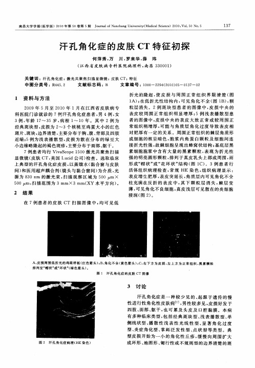 汗孔角化症的皮肤CT特征初探