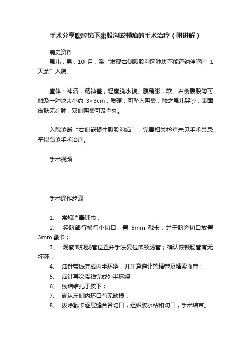 手术分享腹腔镜下腹股沟嵌顿疝的手术治疗（附讲解）