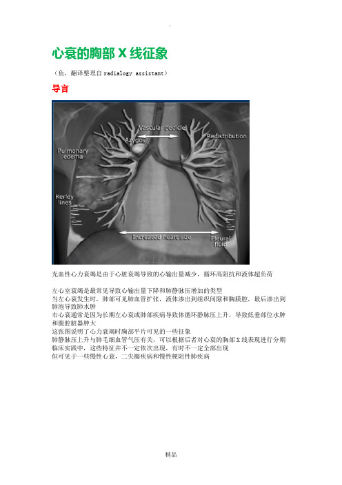 心衰的胸部X线征象