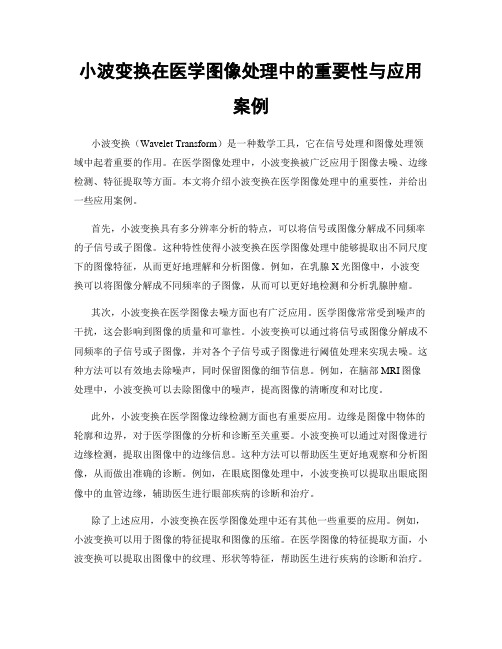 小波变换在医学图像处理中的重要性与应用案例