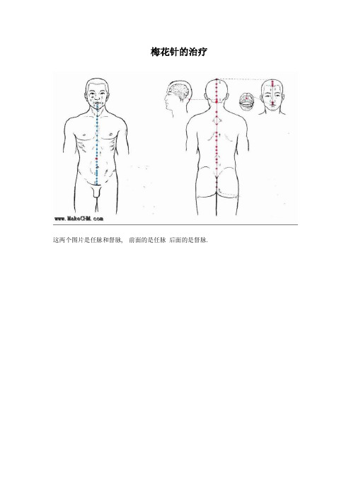 梅花针治疗