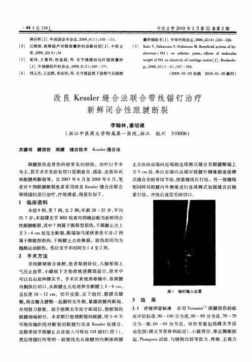 改良Kessler缝合法联合带线锚钉治疗新鲜闭合性跟腱断裂