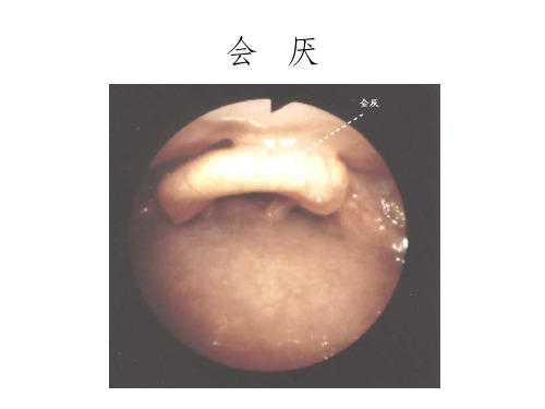 《纤支镜的临床图谱》