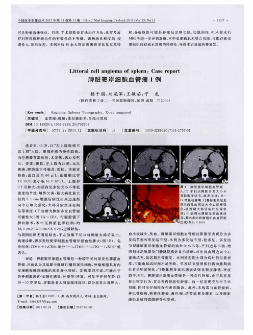 脾脏窦岸细胞血管瘤1例