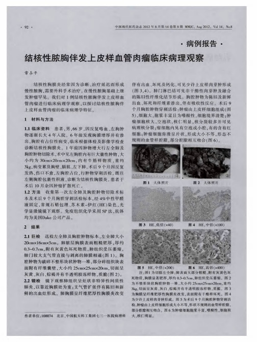 结核性脓胸伴发上皮样血管肉瘤临床病理观察