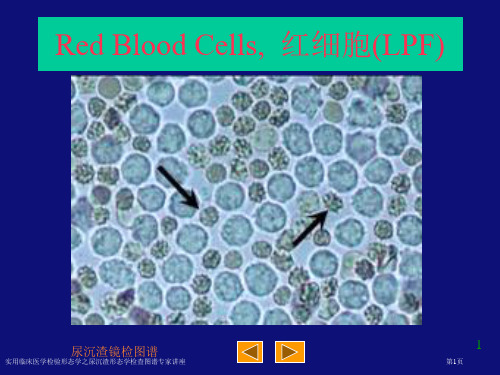 实用临床医学检验形态学之尿沉渣形态学检查图谱专家讲座