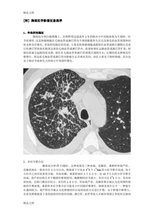 (整理)胸部医学影像征象集萃