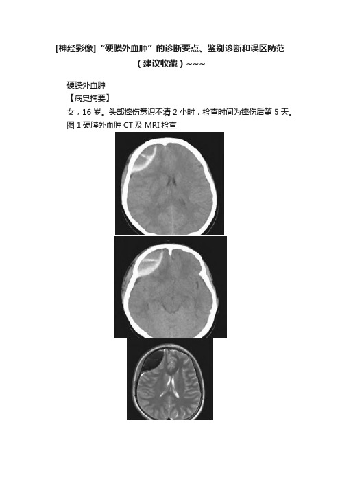 [神经影像]“硬膜外血肿”的诊断要点、鉴别诊断和误区防范（建议收藏）~~~