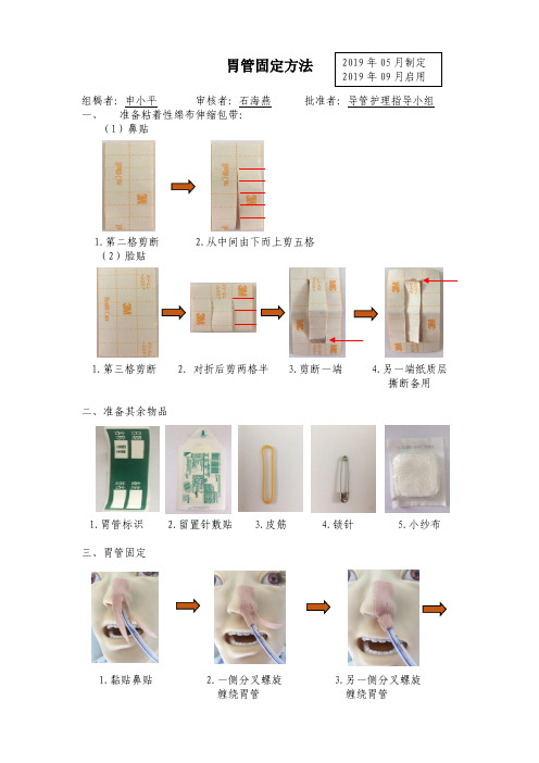 20190601胃管的固定 -