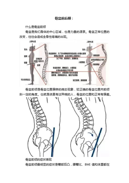 骨盆前后倾：