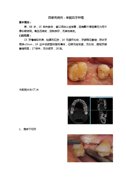 C-Tech单颗种植病例