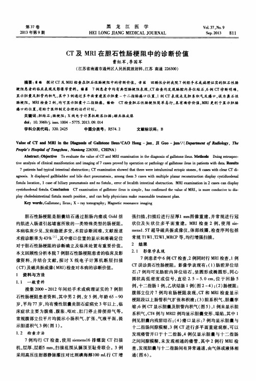 CT及MRI在胆石性肠梗阻中的诊断价值