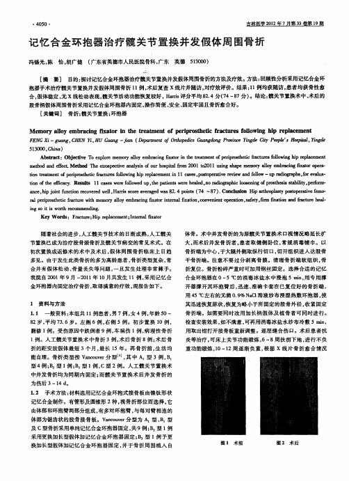 记忆合金环抱器治疗髋关节置换并发假体周围骨折