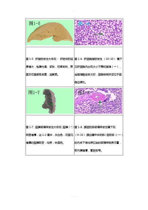 病理切片