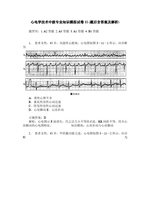 心电学技术中级专业知识模拟试卷11(题后含答案及解析)