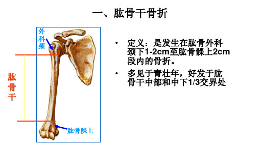 常见四肢骨折的护理PPT课件