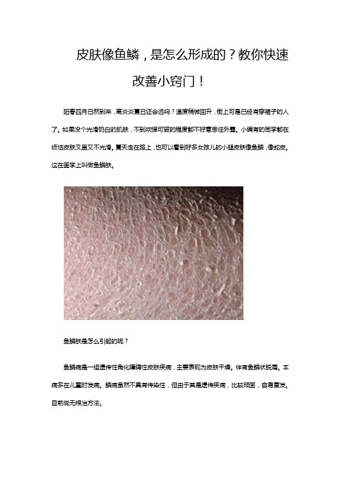 皮肤像鱼鳞,是怎么形成的？教你快速改善小窍门!