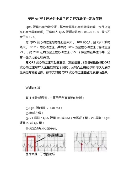 室速or室上速还分不清？这7种方法你一定没掌握