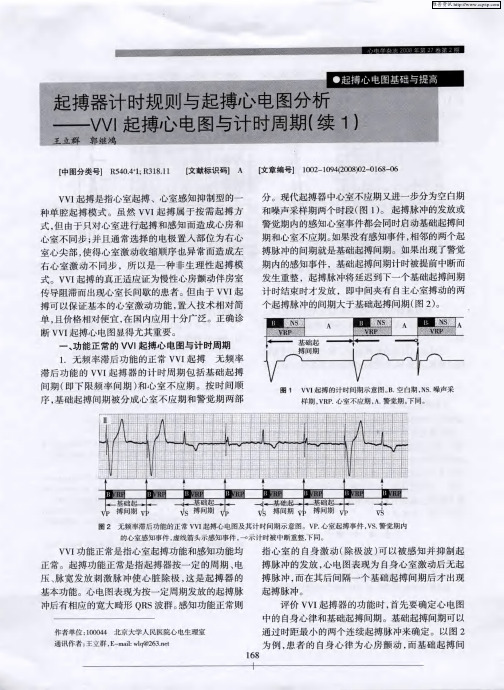 起搏器计时规则与起搏心电图分析——VVI起搏心电图与计时周期(续1)