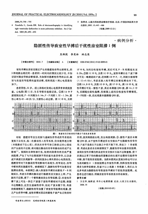 隐匿性传导致室性早搏后干扰性房室阻滞1例