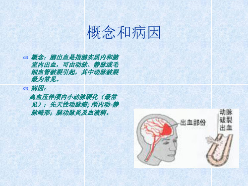 脑出血教学查房PPT通用课件