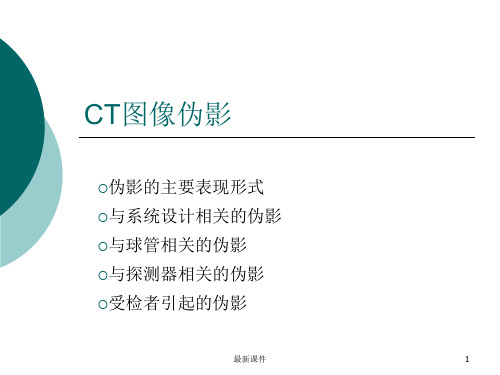 CT图像伪影