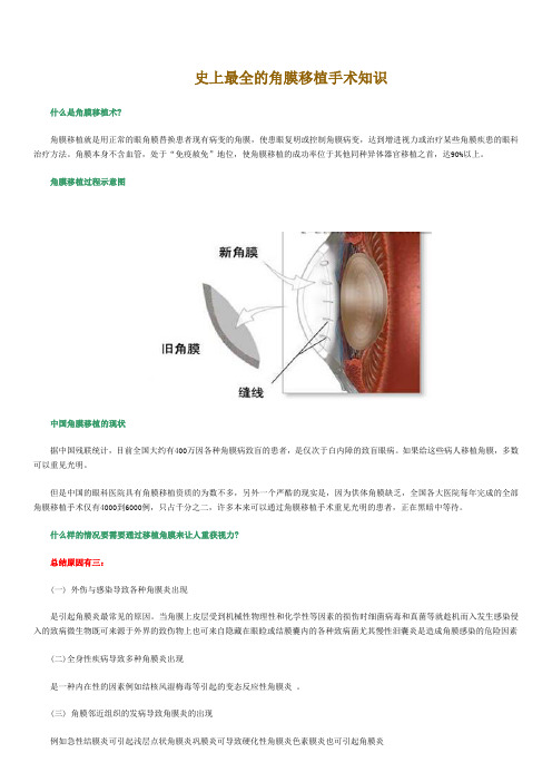 史上最全的角膜移植手术知识