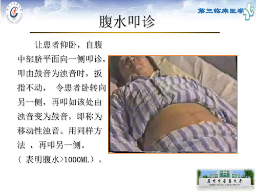 诊断学腹部6 (1)