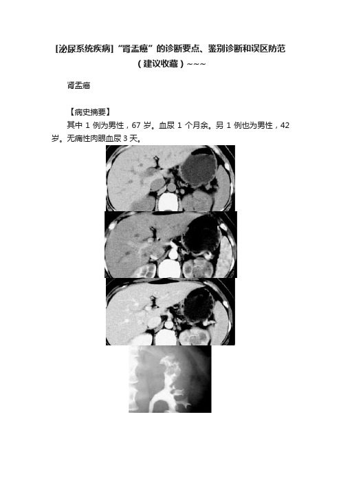 [泌尿系统疾病]“肾盂癌”的诊断要点、鉴别诊断和误区防范（建议收藏）~~~