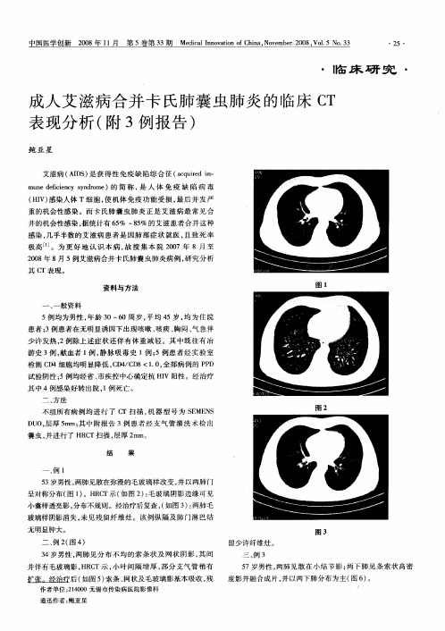 成人艾滋病合并卡氏肺囊虫肺炎的临床CT表现分析(附3例报告)