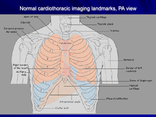 影像学-肺脏结构图片及X线表