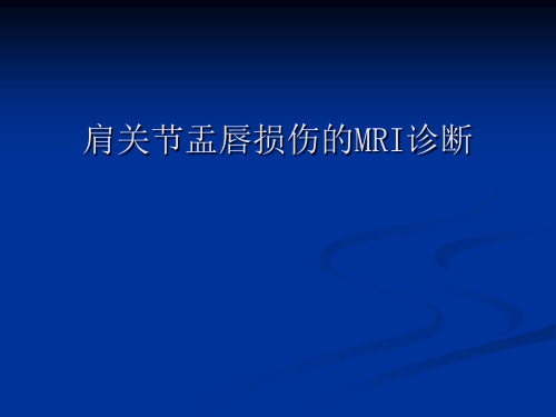 肩关节盂唇损伤的MRI诊断