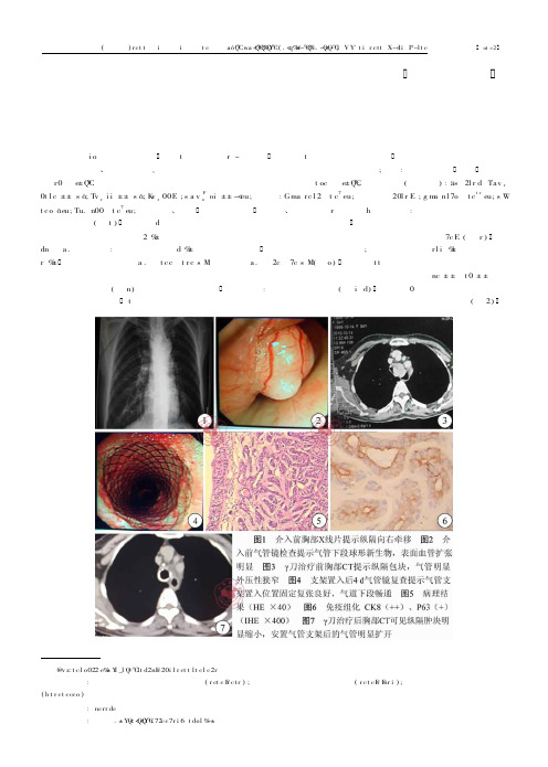 经电子气管镜介入联合放疗治疗大气道腺样囊性癌一例
