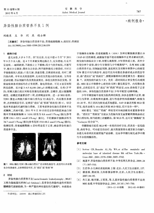 异染性脑白质营养不良1例