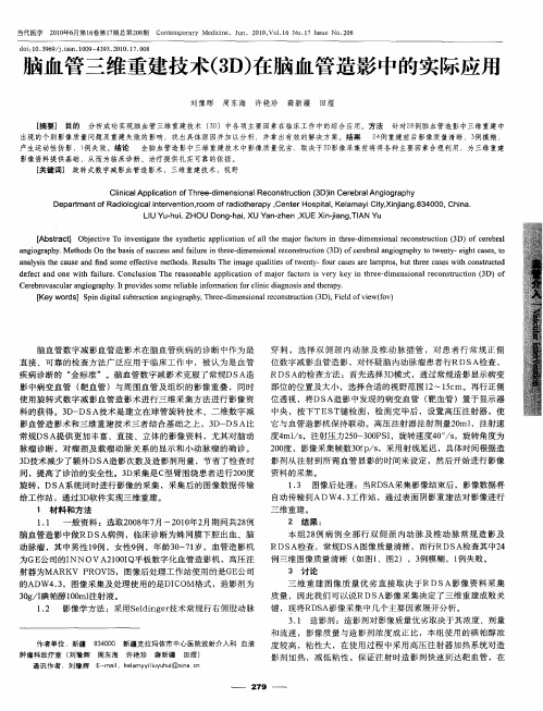 脑血管三维重建技术(3D)在脑血管造影中的实际应用