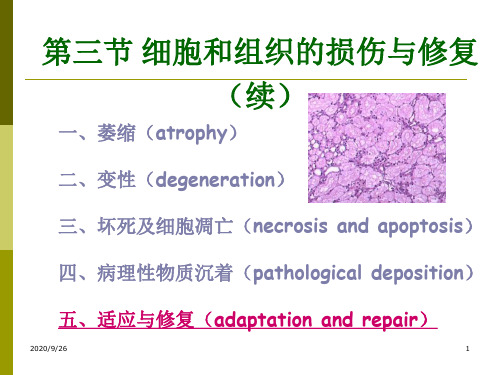 病理学第三节细胞和组织的损伤与修复