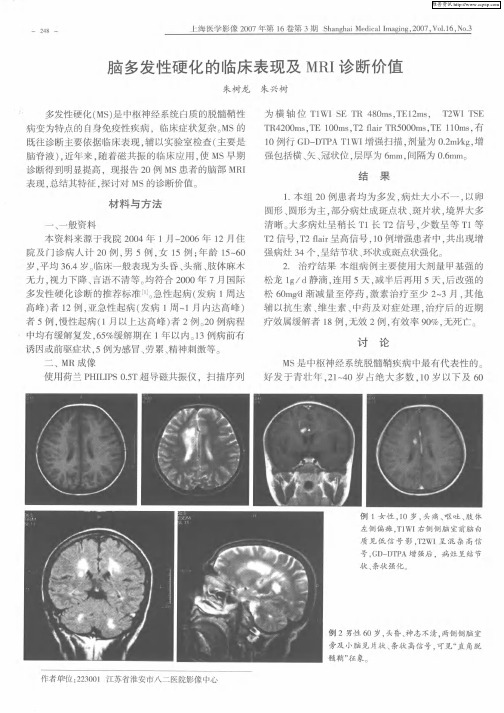 脑多发性硬化的临床表现及MRI诊断价值